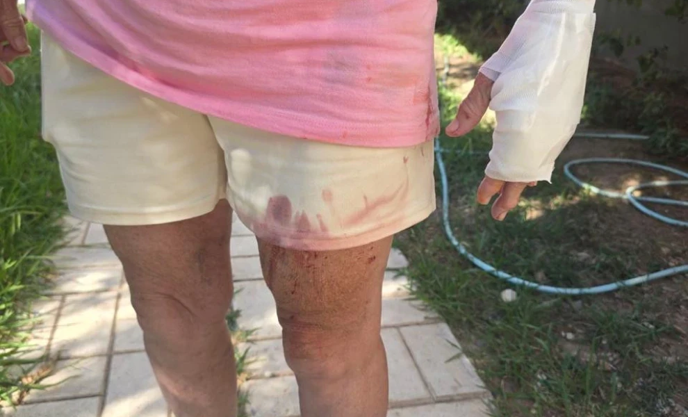 Ποινική δίωξη για δύο πλημμελήματα στη θεία του Στέφανου Τσιτσιπά για την επίθεση σκυλιών στη Βάρη